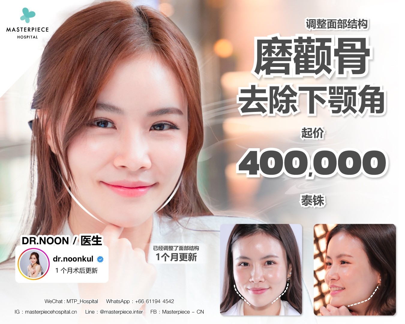 面部整形手术的优惠