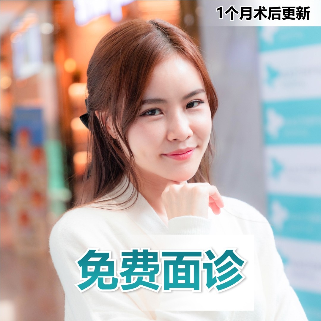 面部整形手术的案例