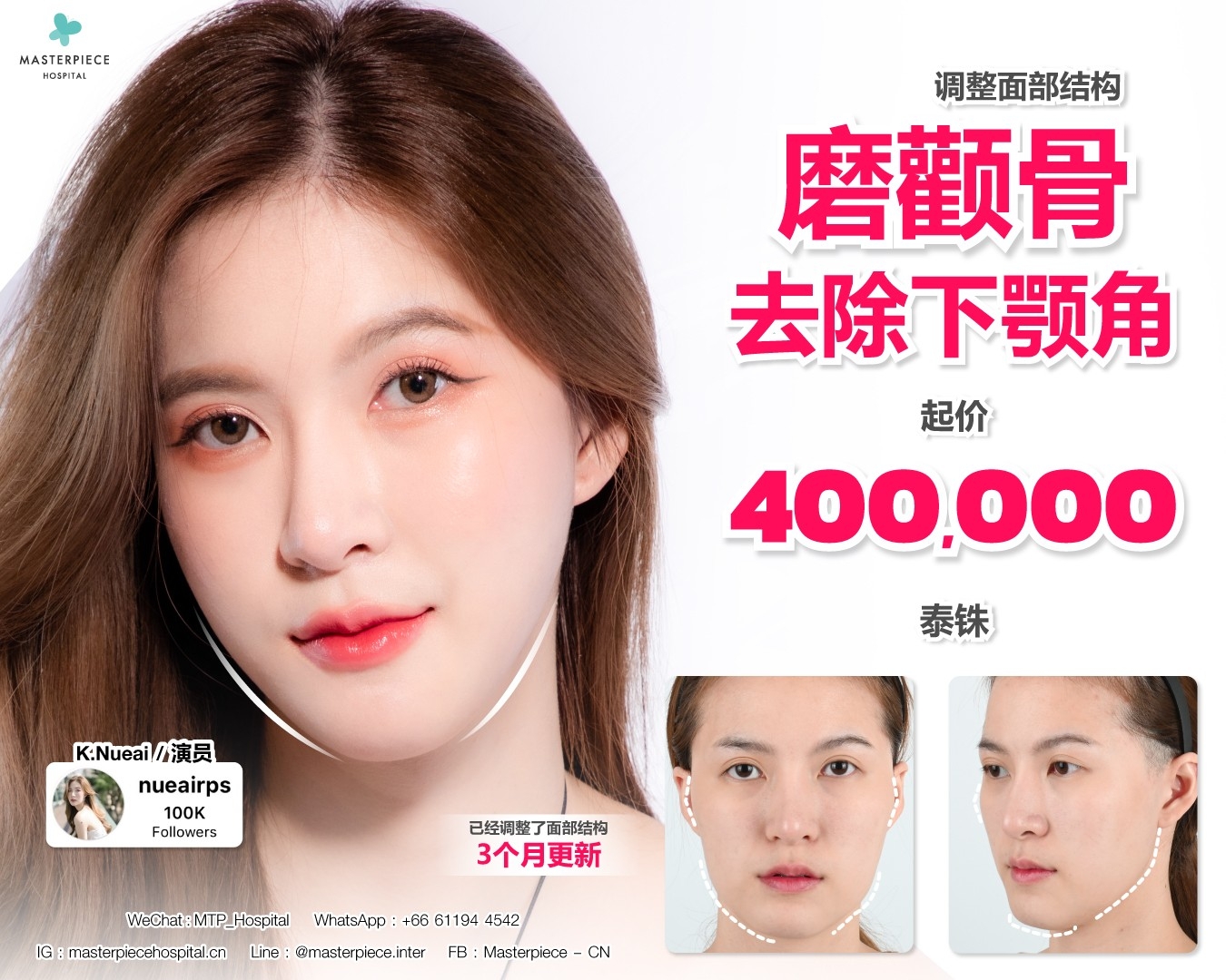 面部整形手术的优惠