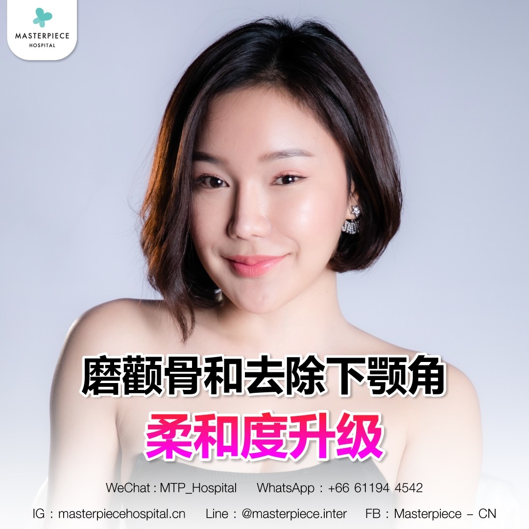 面部整形手术的案例