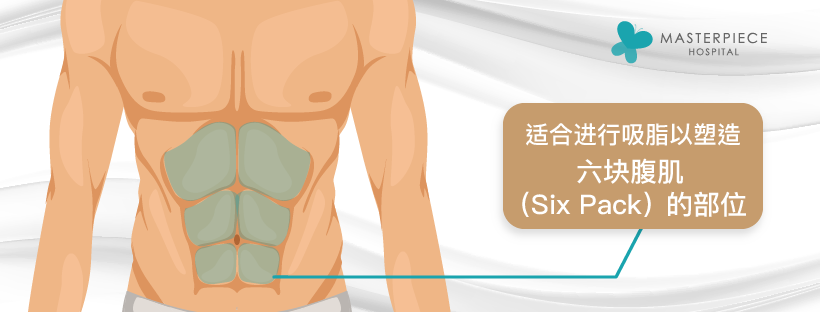 适合六块腹肌抽脂肪的正确位置