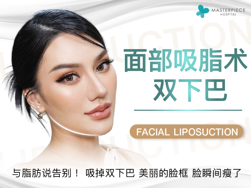 面部吸脂术.双下巴