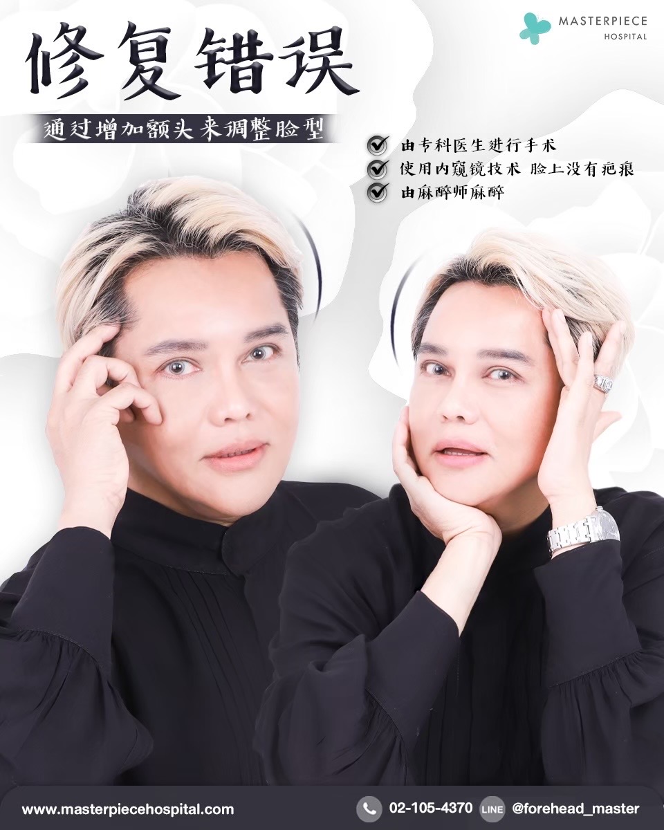 隆额头手术的案例