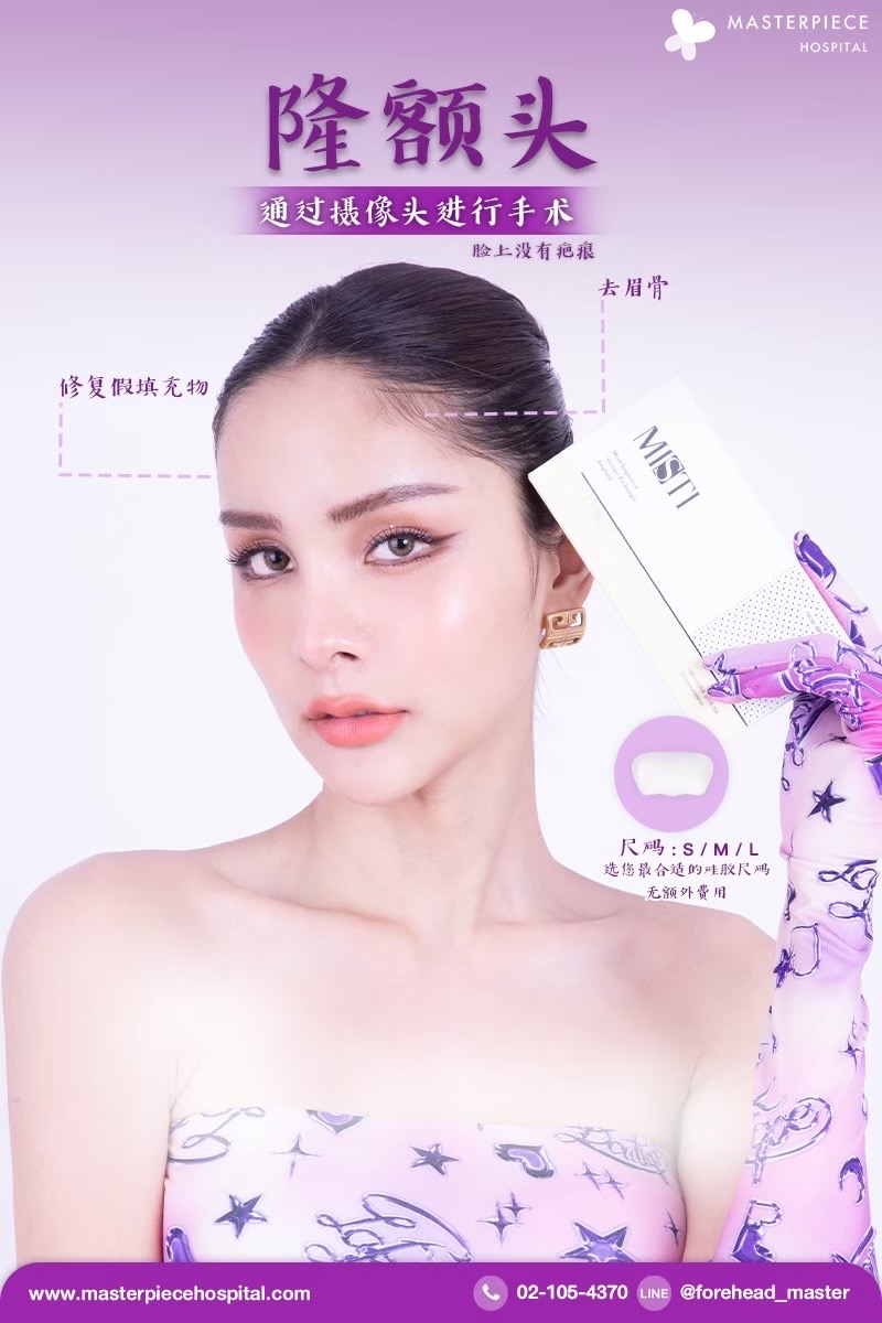隆额头手术的案例