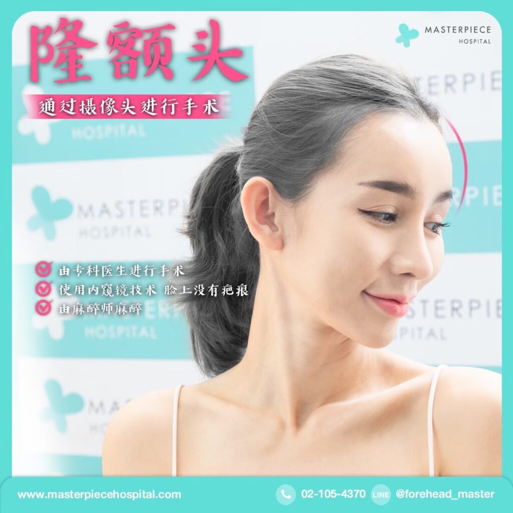 隆额头手术的案例