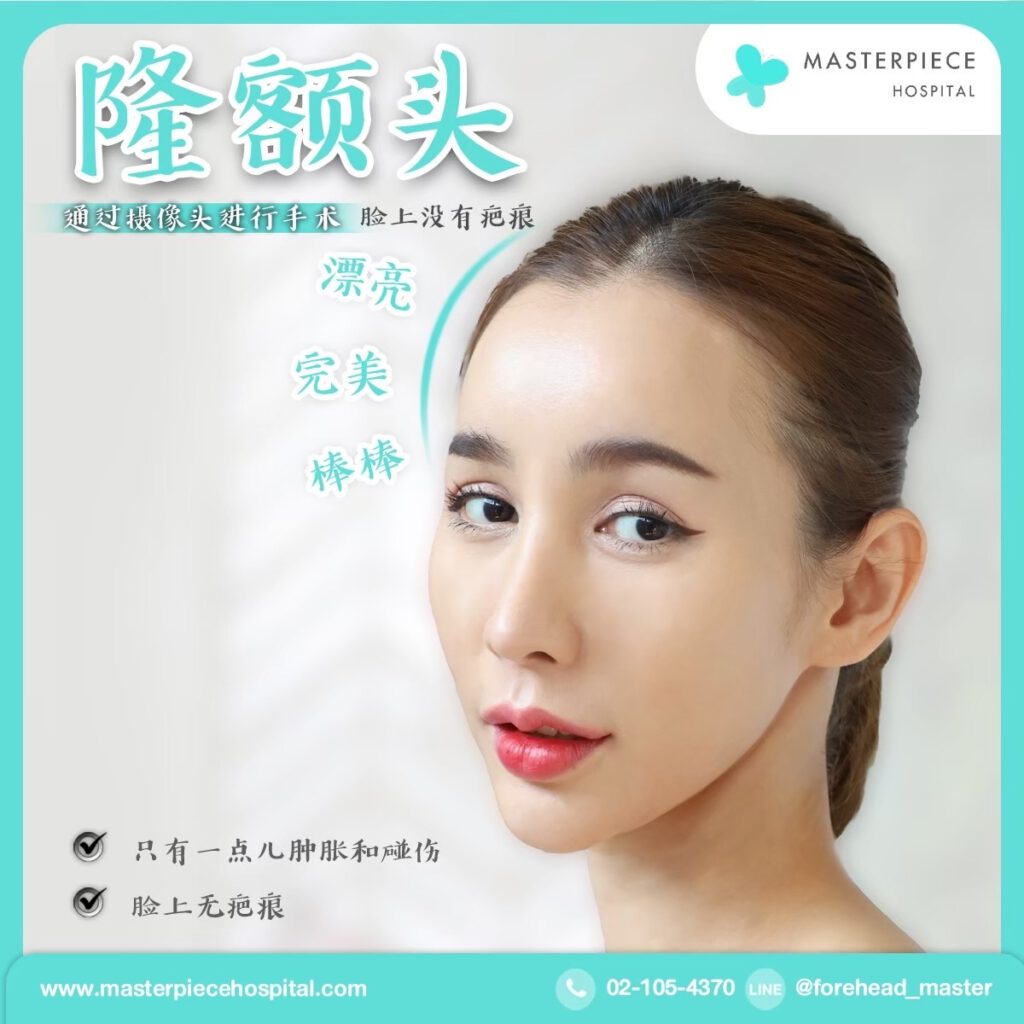 隆额头手术的案例