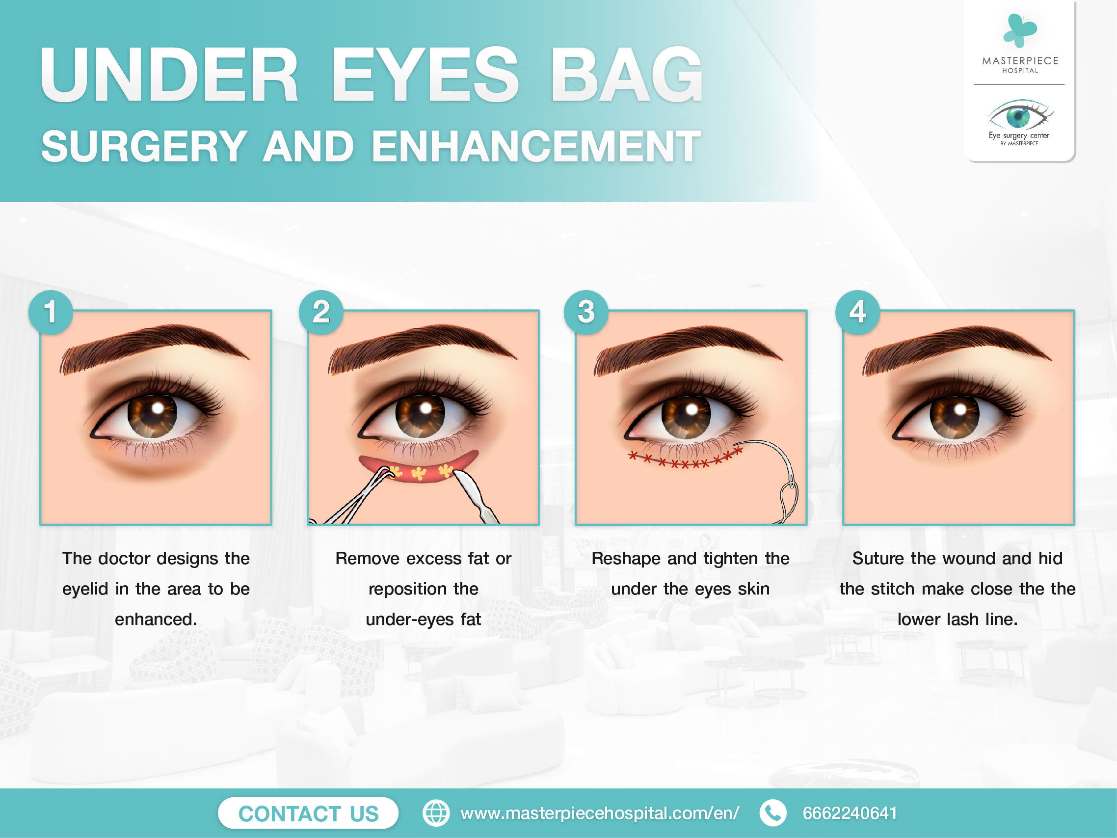 Under-eye bag surgery reduces aging signs., image size:2276x1707