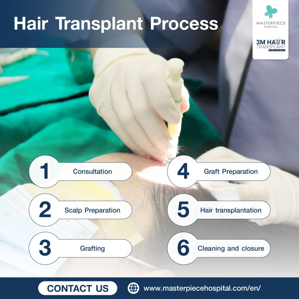 Hair Transplant for Thinning Hair | Permanent Hair Restoration