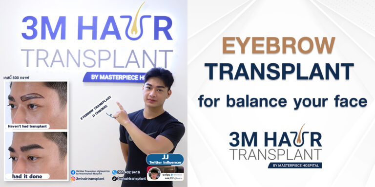 Eyebrow Transplant solves the problem of sparse or missing eyebrows, creates a beautiful eyebrow shape, and adds dimension to the eyebrows.