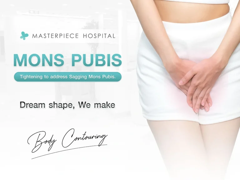 What is the Mons Pubis? Mons Pubis Tightening to address Sagging Mons Pubis.
