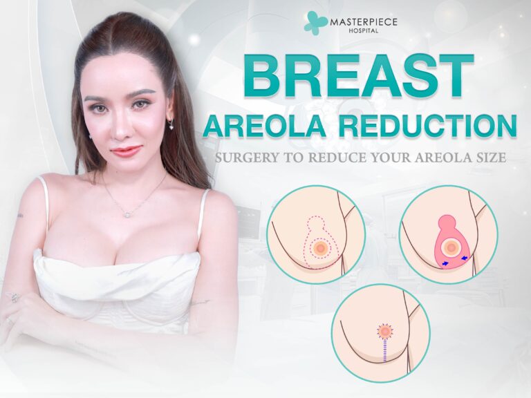 Large, misshapen, or wide areolas problems can be corrected by Areola reduction.