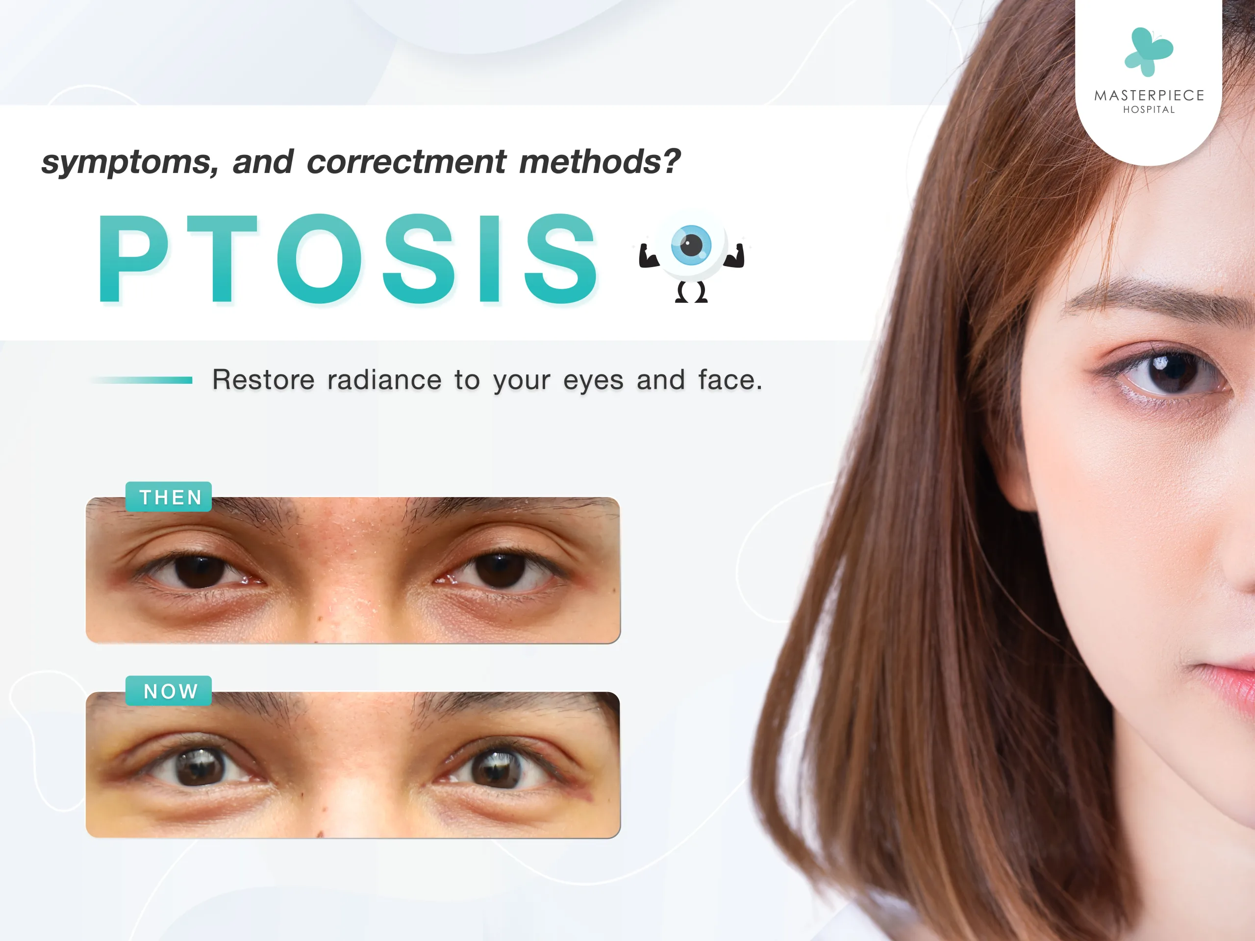 What causes the Ptosis, symptoms, and correctment methods?