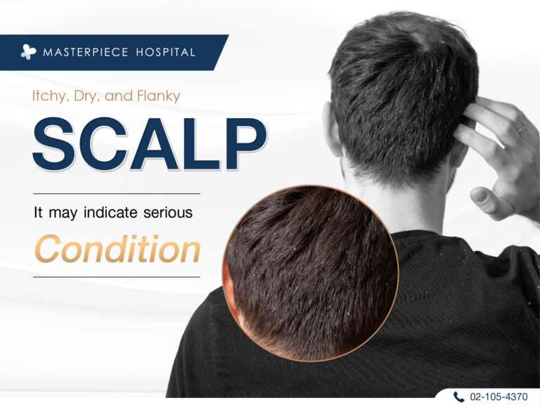 Dry, Flaky Scalp May Indicate an Underlying Serious Condition