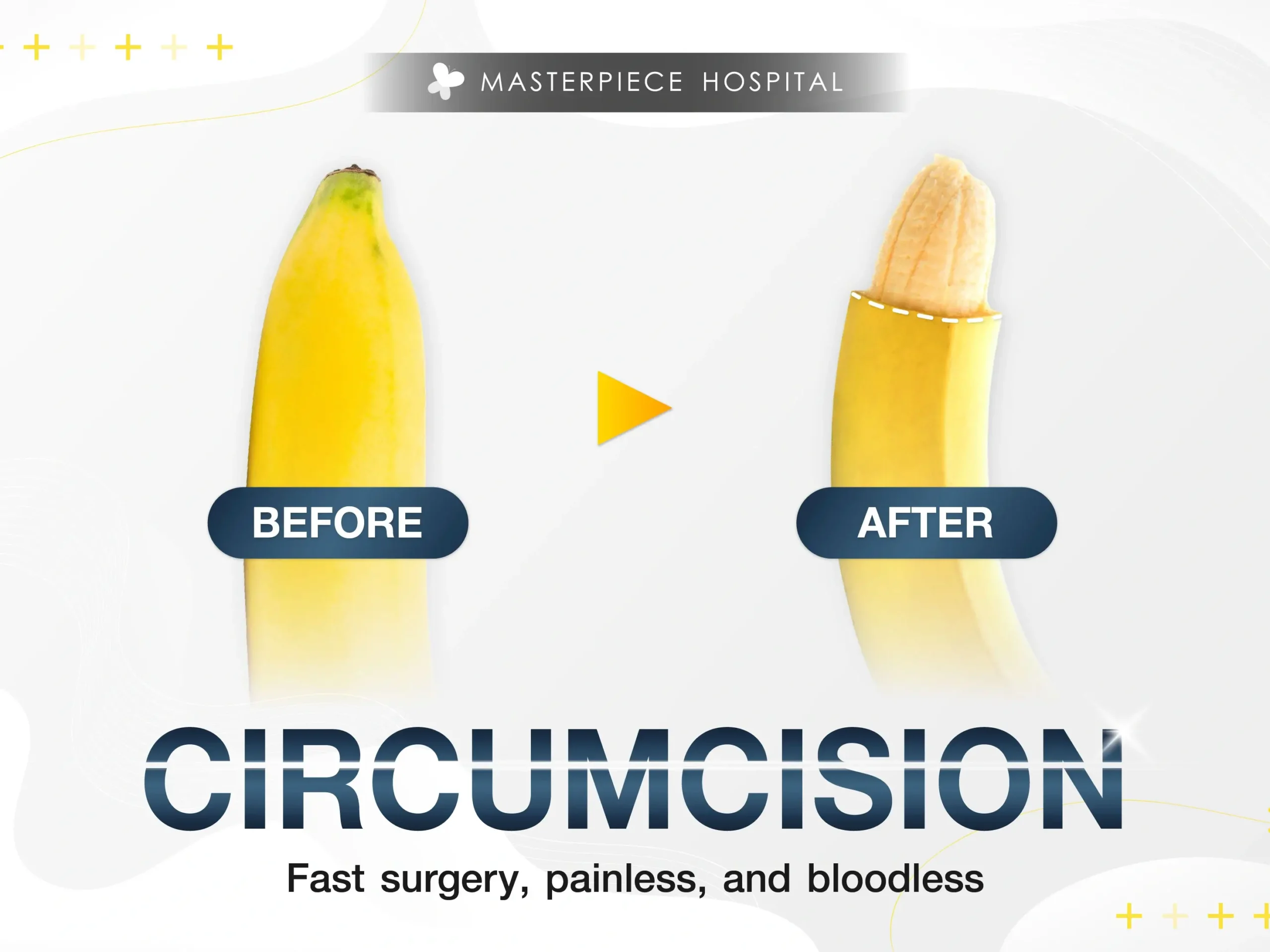Circumcision