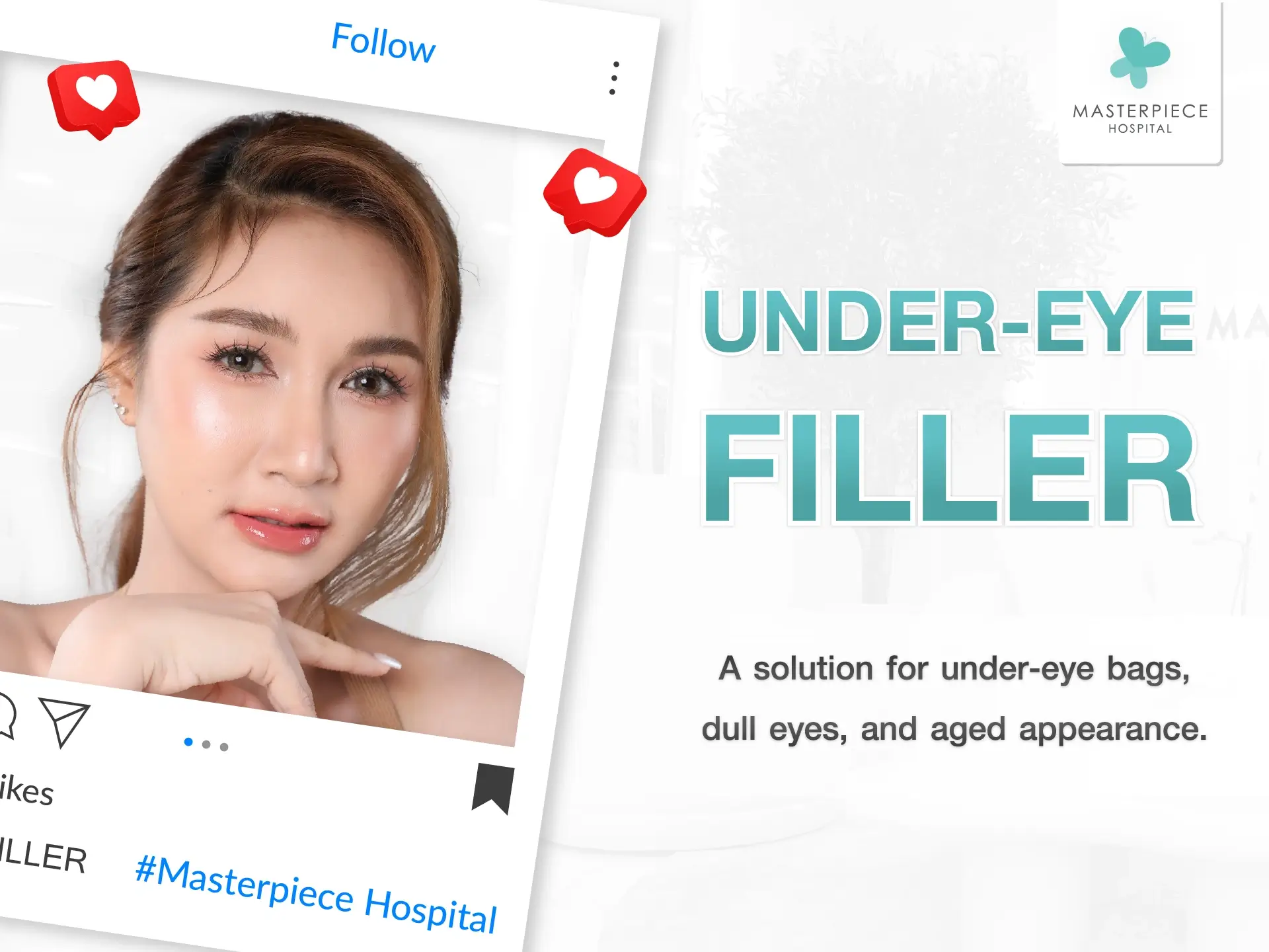 Under-eye filler: A solution for under-eye bags, dull-looking eyes, and an aged appearance.
