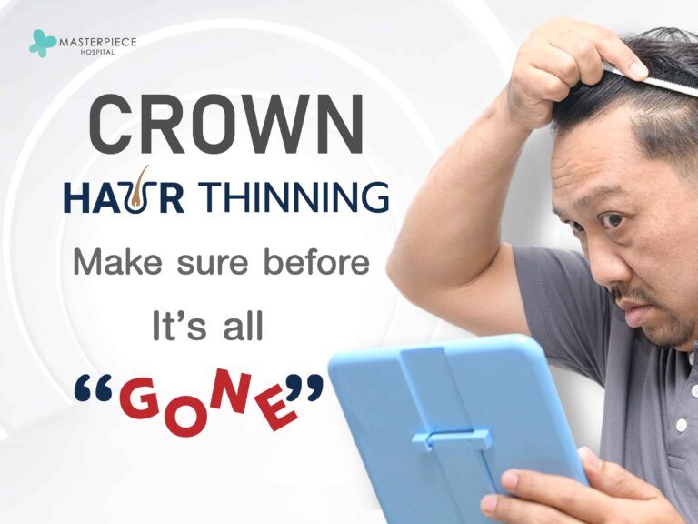 Crown hair thinning? Make sure before it’s all gone.