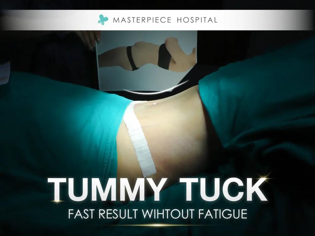 Tummy Truck: A quick solution for those seeking fast results without the effort
