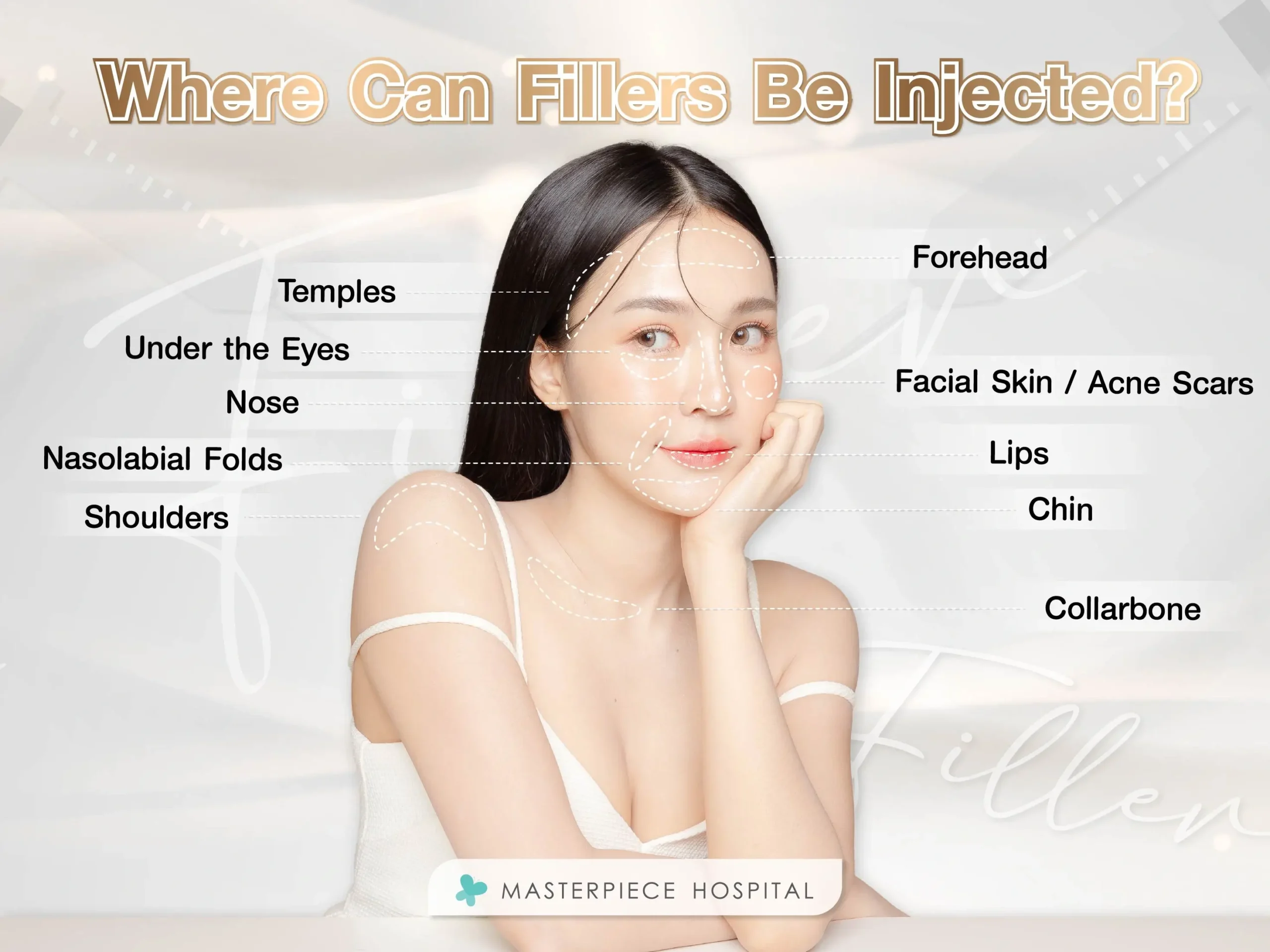 Where Can Fillers Be Injected?