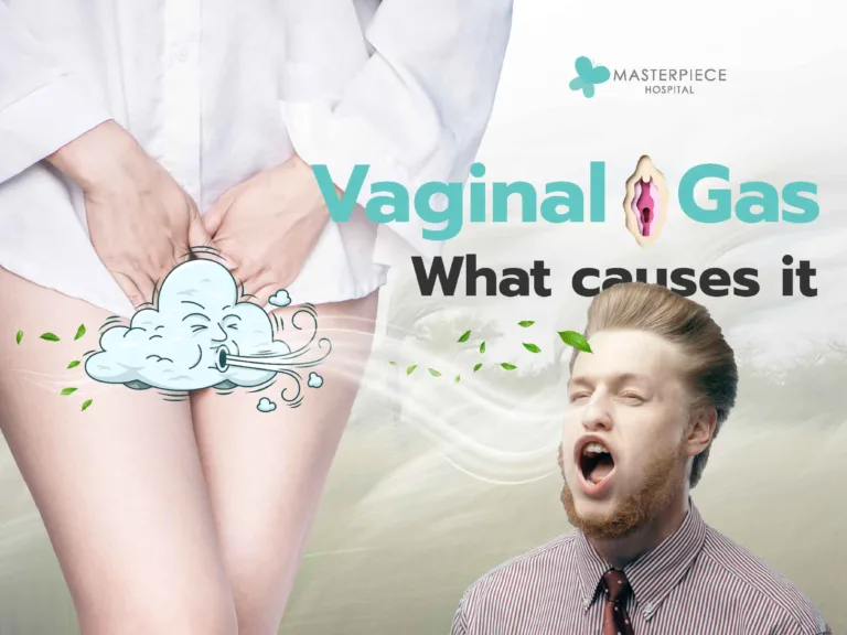 Vaginal Gas: causes of Vaginal Flatulence and treatment methods