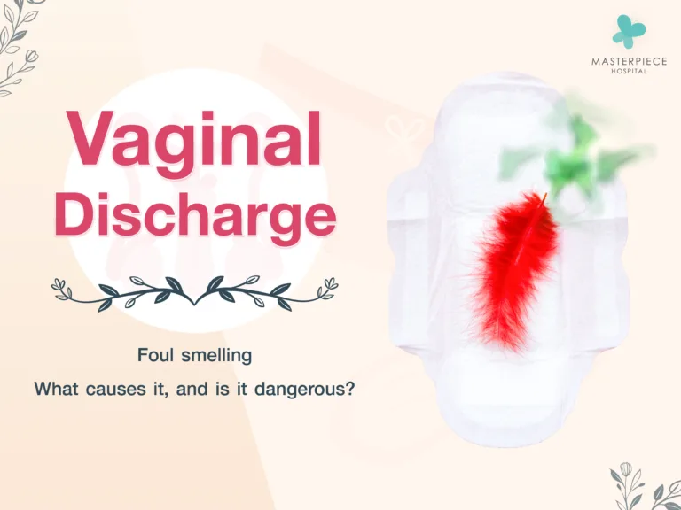 What are the causes of foul-smelling vaginal discharge without itching, and is it a serious condition?