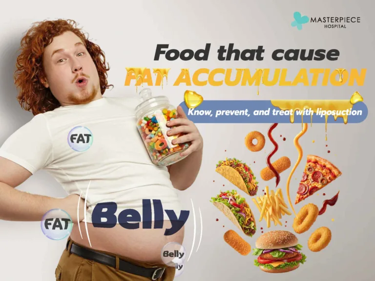 Foods that cause fat accumulation: know, prevent, and treat with liposuction