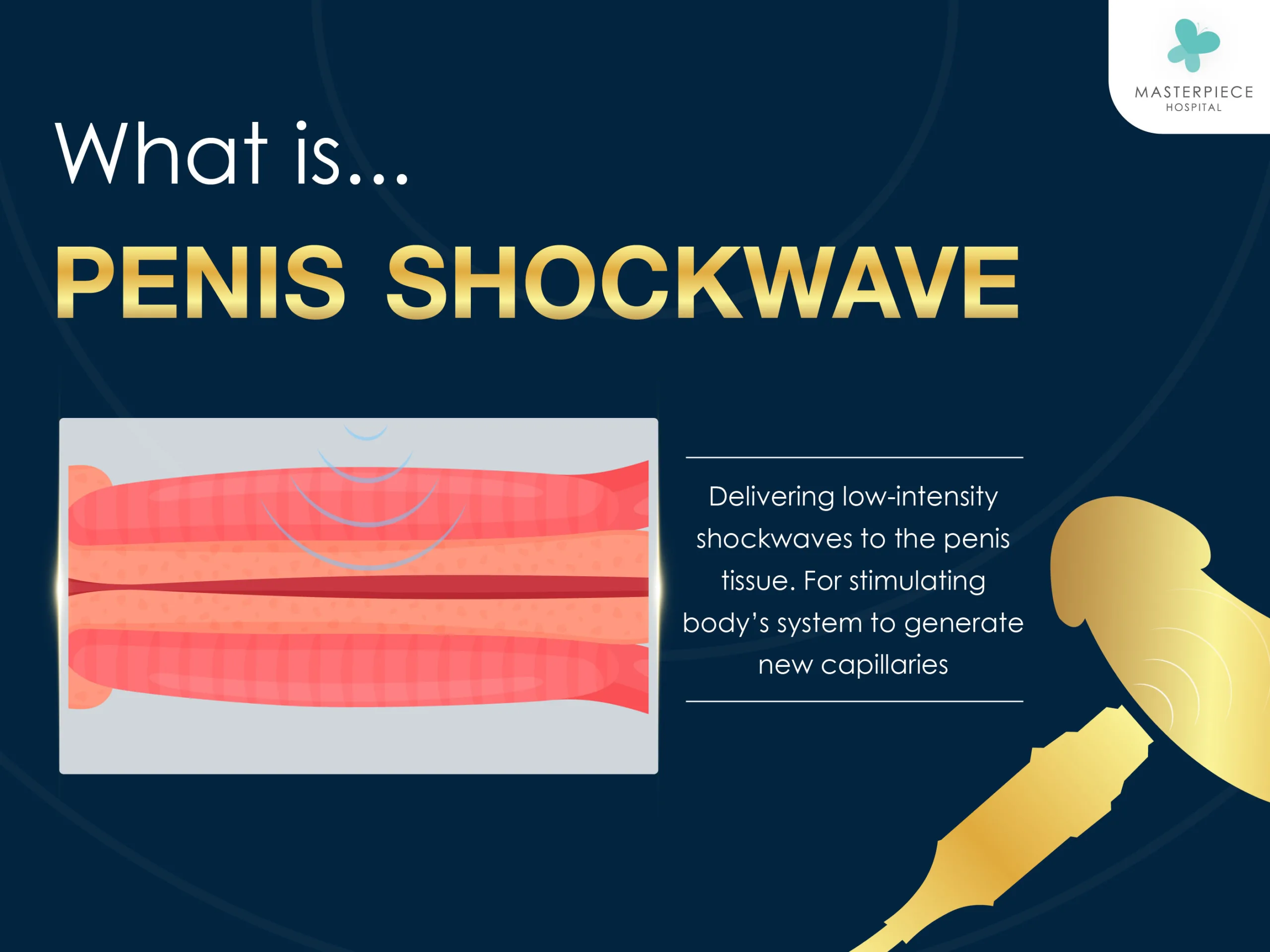 What is Penis Shockwave