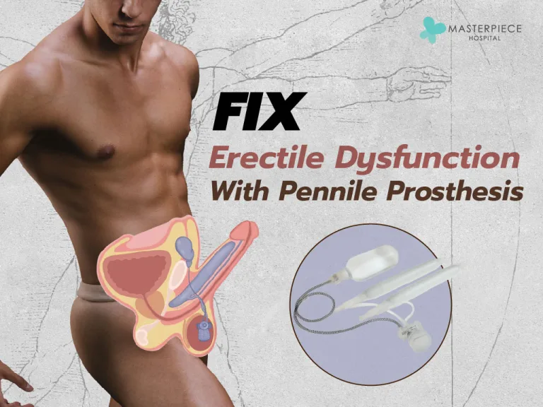 Engpenileprosthesis