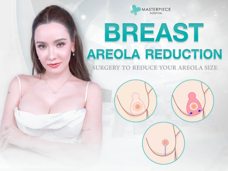 Masalah Areola Besar, Bentuk Tidak Proporsional, dan Areola Lebar – Dapat Dikurangi Ukurannya