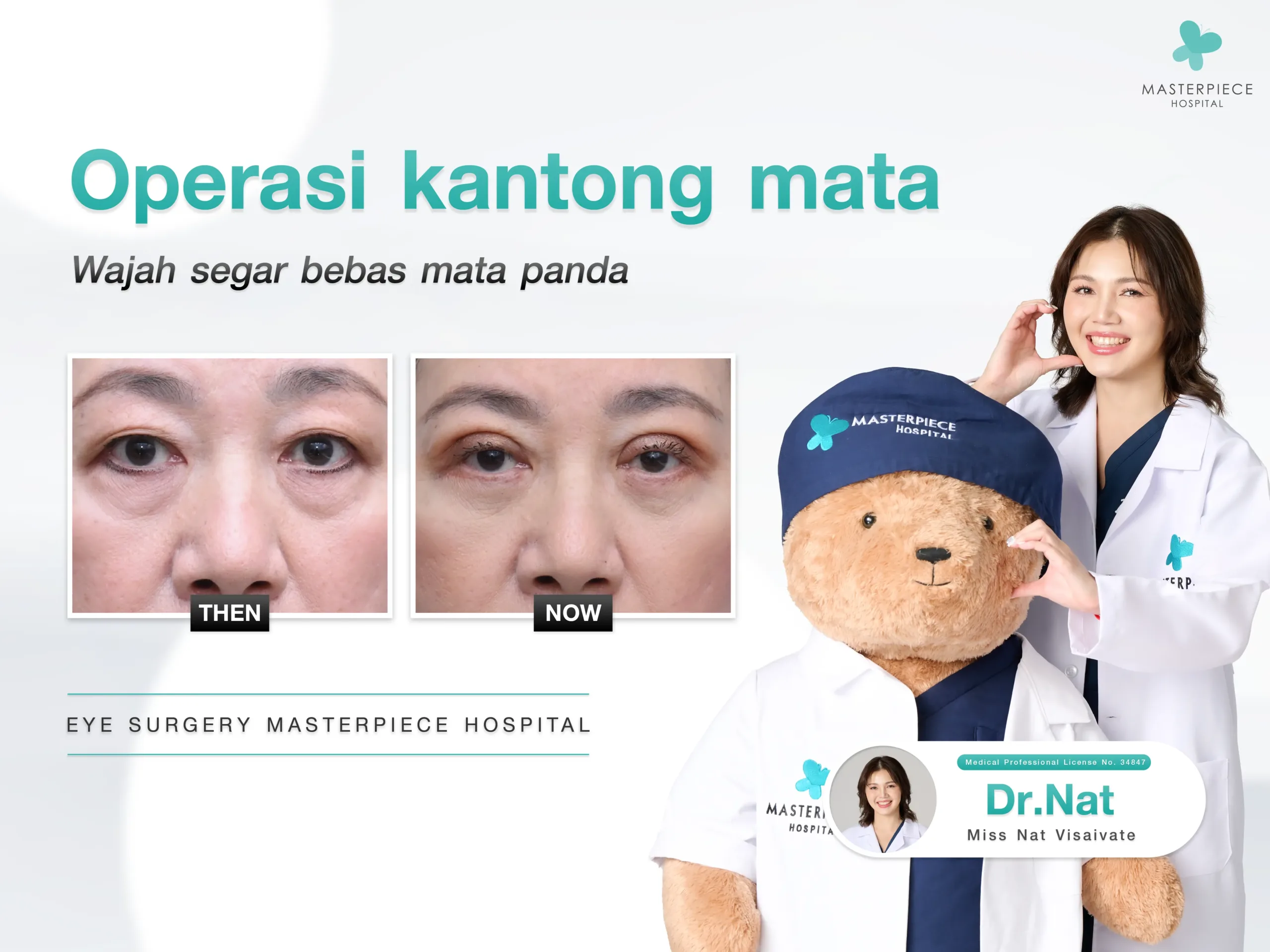 Operasi Kantung Mata (Eye Bags Removal)