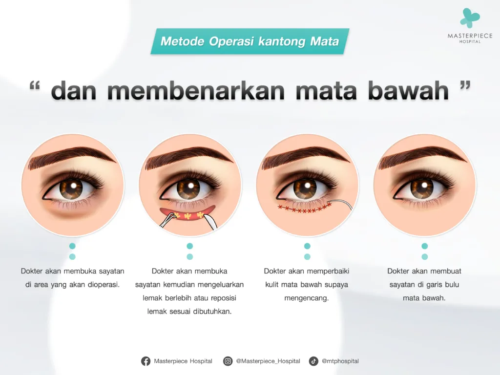 Apa Saja Cara untuk Membuat Area Bawah Mata Tampak Cerah dan Muda Kembali