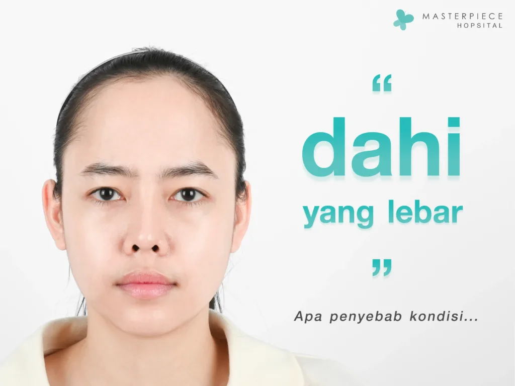 Penyebab Dahi Lebar