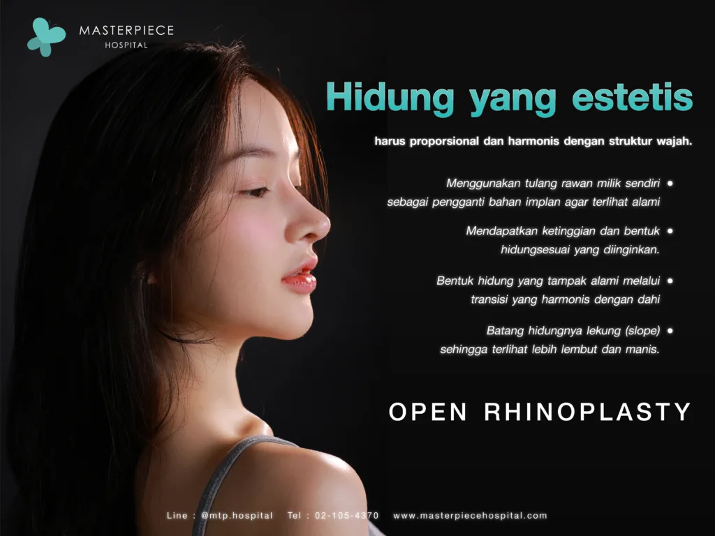Hidung yang estetis