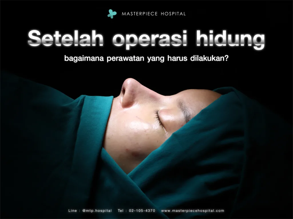 Setelah operasi hidung
