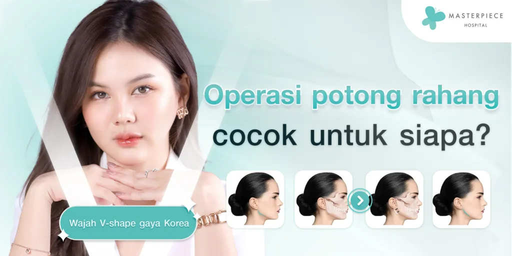 Siapa yang Cocok untuk Operasi Rahang