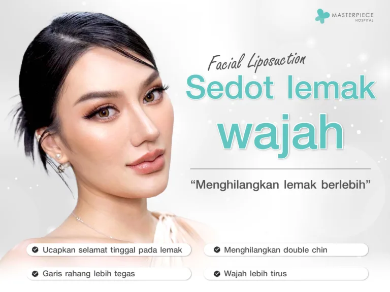 Sedot Lemak Wajah: Menghilangkan Lemak Berlebih di Area Wajah
