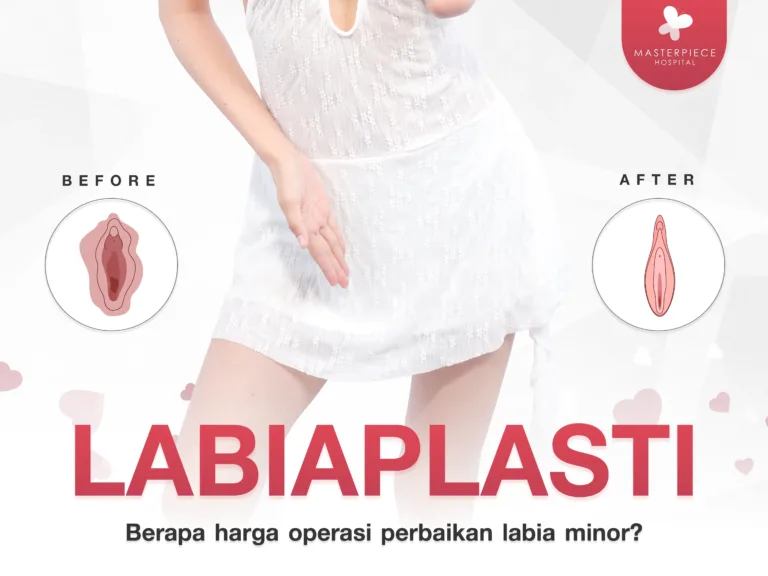 Apa itu Labia? Apa Penyebabnya? Berapa Biaya Operasi Estetika Labia Minora? Apakah Berbahaya?