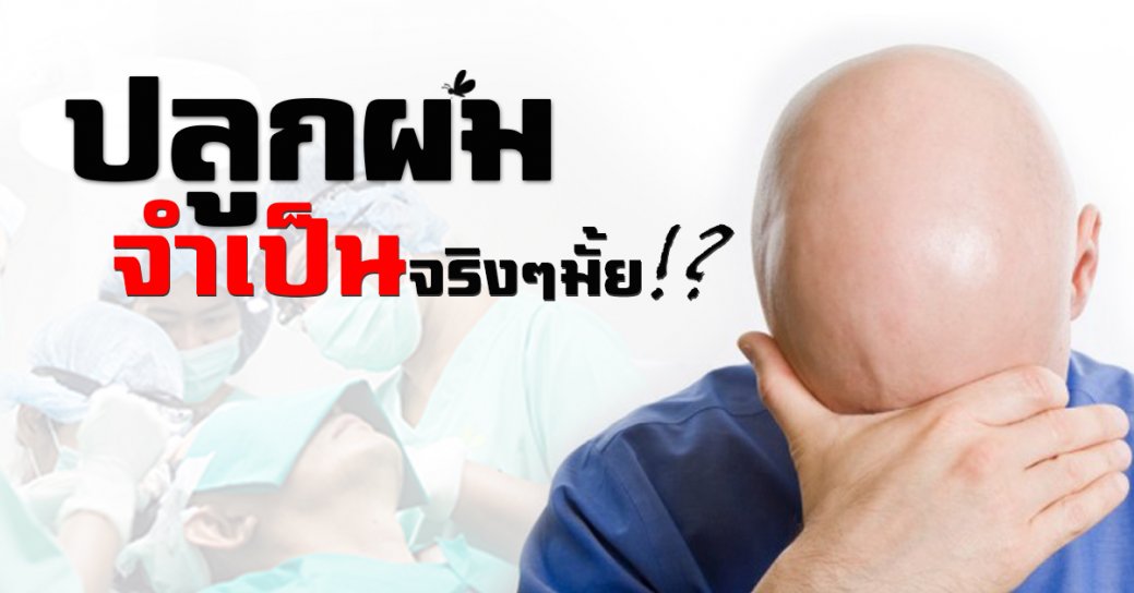 ปลูกผมจำเป็นจริงๆ มั้ย!?