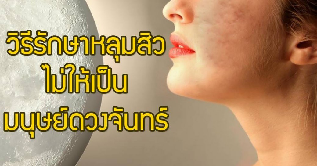 วิธีรักษาหลุมสิวไม่ให้เป็นมนุษย์ดวงจันทร์ (Demo)