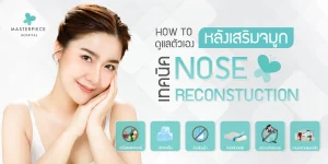 HOW TO ดูแลตัวเองหลังเสริมจมูก “เทคนิค NOSE RECONSTRUCTION”