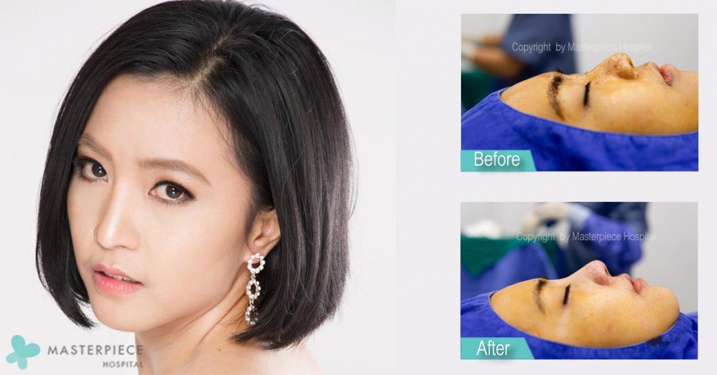 3.-ฝ้าย-มิรันตี
