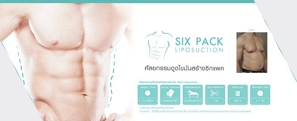 ศัลยกรรมตัดหนังหน้าท้อง