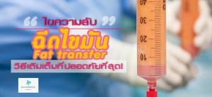 ฉีดไขมัน fat transfer