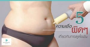 6 คำถามสุดฮิต หลังดูดไขมัน
