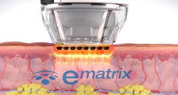 ematrix