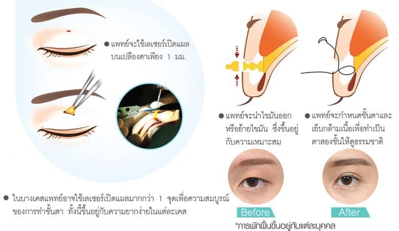 ตาสองชั้น