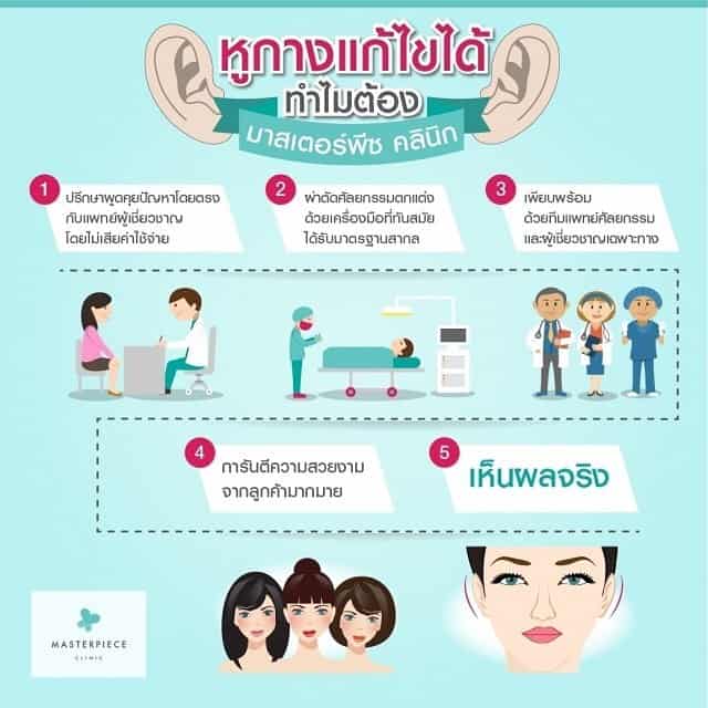 หูกางแก้ไขได้