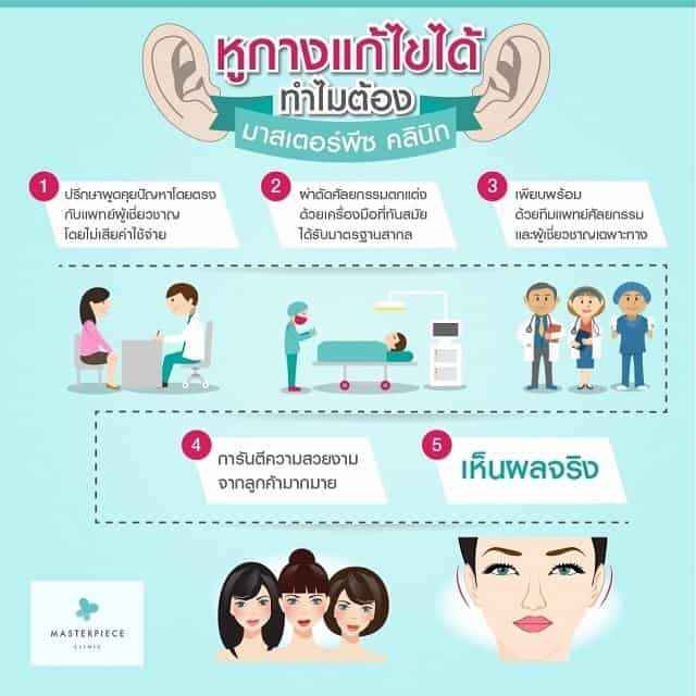 ทำไมต้องศัลยกรรม แก้ไขหูกาง กับมาสเตอร์พีซ