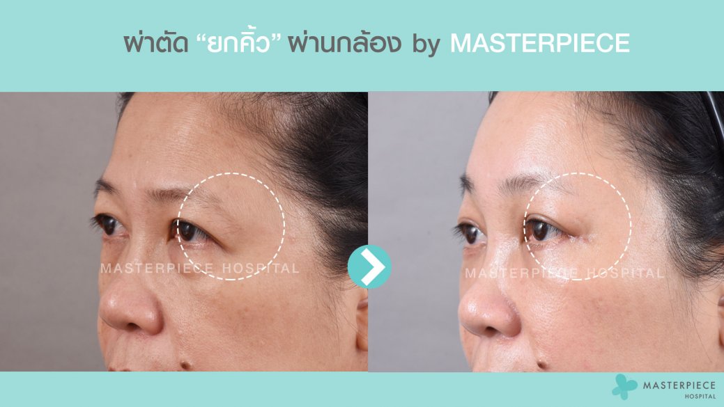 BA ก้อยศิรินุช BA ก้อยศิรินุช