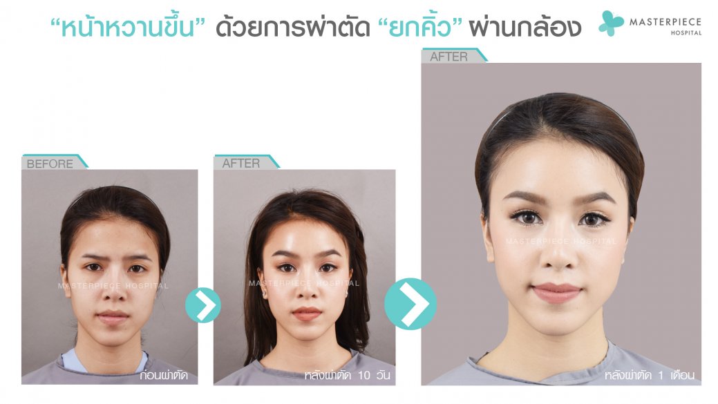 BA คุณกิ๊บ BA คุณกิ๊บ