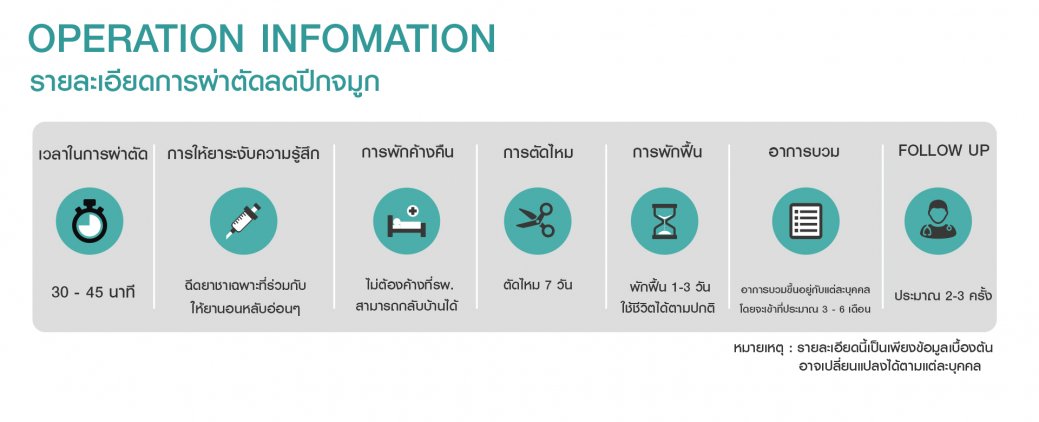 รายละเอียดการผ่าตัดลดปีกจมูก รายละเอียดการผ่าตัดลดปีกจมูก
